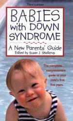 Down Syndrome by 