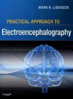 Electroencephalogram (Eeg) by 