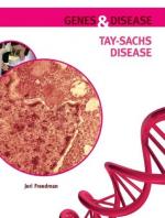 Tay-Sachs Disease by 
