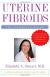 Uterine Fibroids Encyclopedia Article